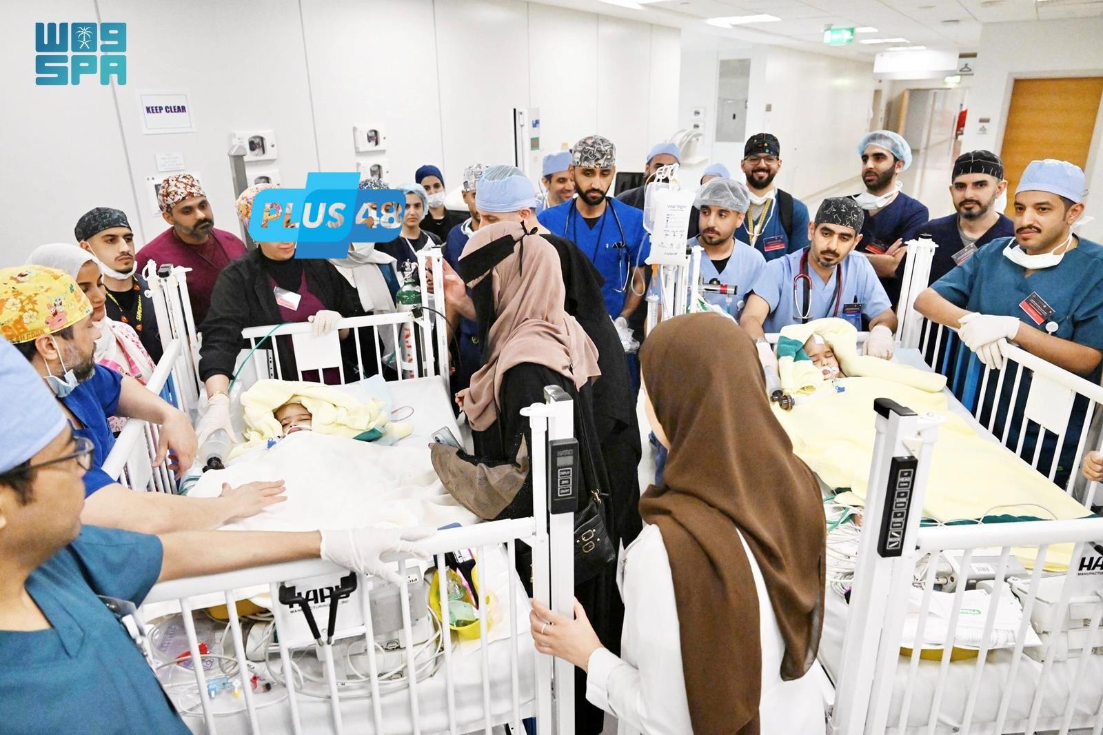 نجاح عملية فصل التوأم الملتصق الإريتري “أسماء وسمية”  #عاجل