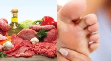 مرضى النقرس في عيد الأضحى.. كيف تتناول اللحوم بأمان؟