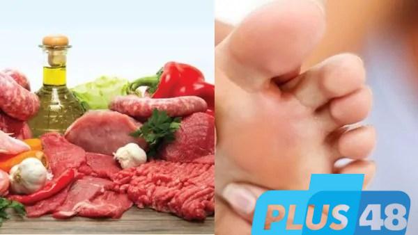 مرضى النقرس في عيد الأضحى.. كيف تتناول اللحوم بأمان؟